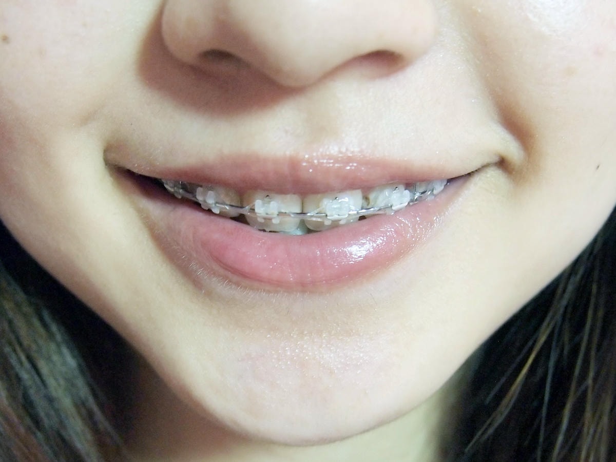 20250828-fs0rt